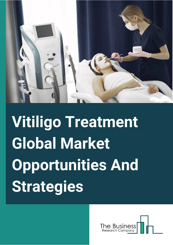 Vitiligo Treatment Global Market Opportunities And Strategies To 2033