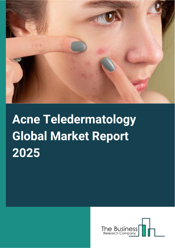 Global Acne Teledermatology Market Report 2025