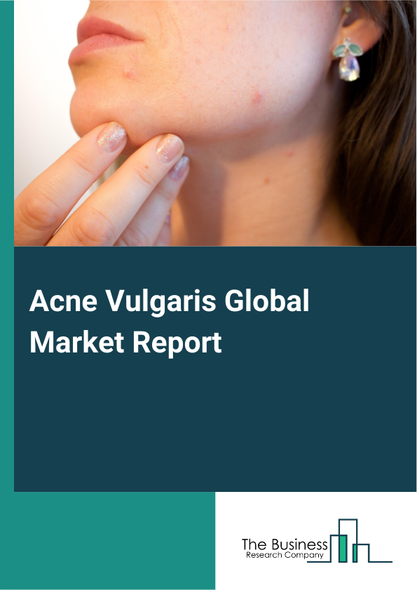 Global Acne Vulgaris Market Report 2025