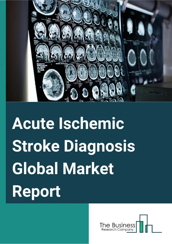 Acute Ischemic Stroke Diagnosis Global Market Report 2023