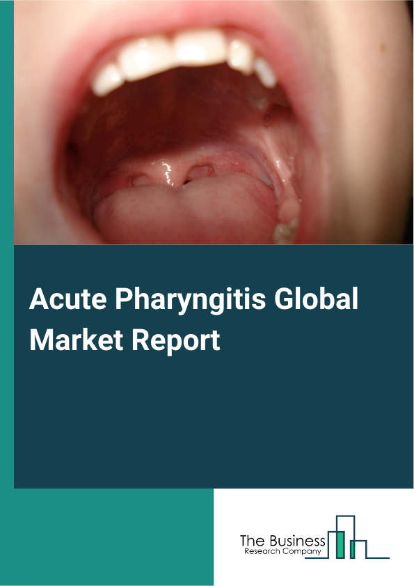 Global Acute Pharyngitis Market Report 2025