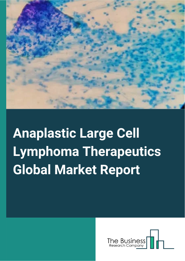 Global Anaplastic Large Cell Lymphoma Therapeutics Market Report 2025