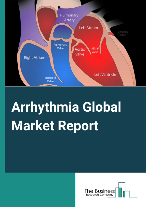 Arrhythmia Market Report 2023