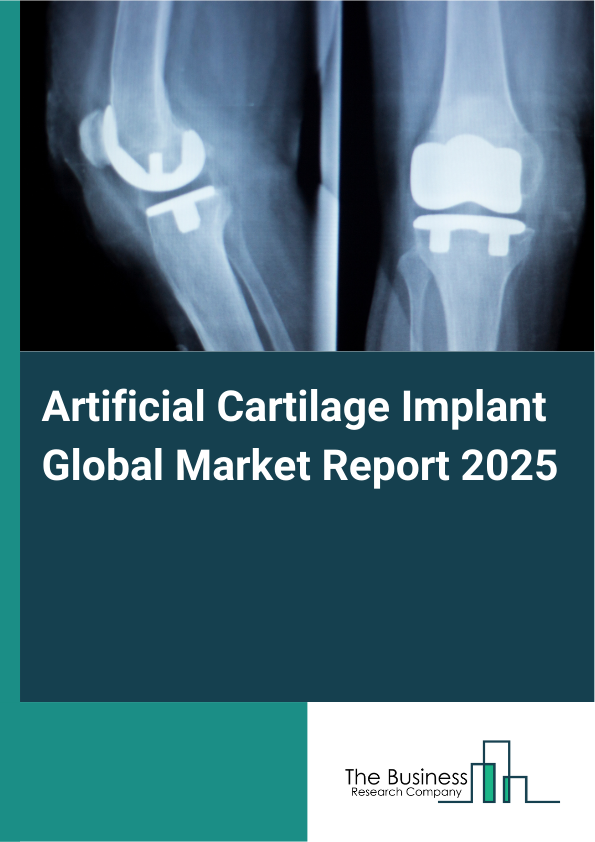 Global Artificial Cartilage Implant Market Report 2025