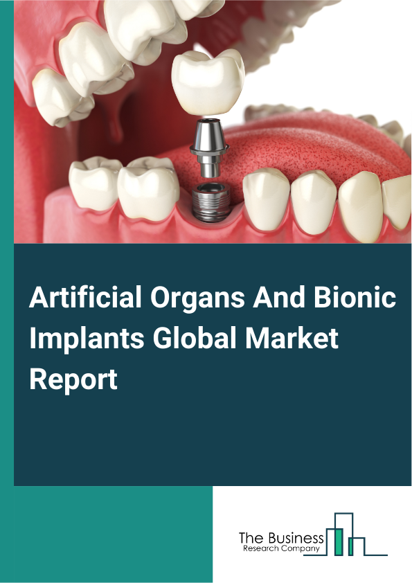 Artificial Organs And Bionic Implants