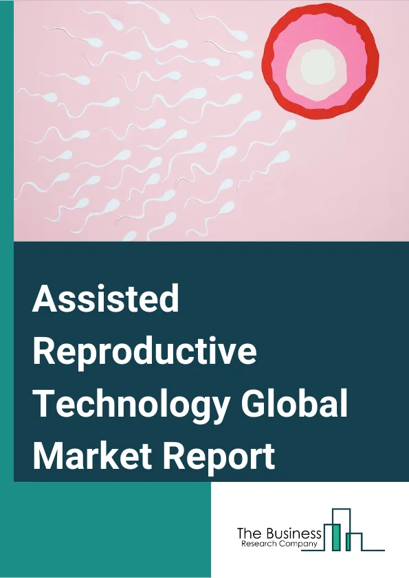 Assisted Reproductive Technology Global Market Report 2024 – By Diagnosis (Ovulation Testing, Hysterosalpingography, Ovarian Reserve Testing, Genetic Testing), By Procedure Type (Fresh Non-Donor, Fresh Donor, Frozen Donor, Frozen Non-Donor, Embryo Or Egg Banking), By End-User (Hospitals, Fertility Clinics, Other End-Users) – Market Size, Trends, And Global Forecast 2024-2033