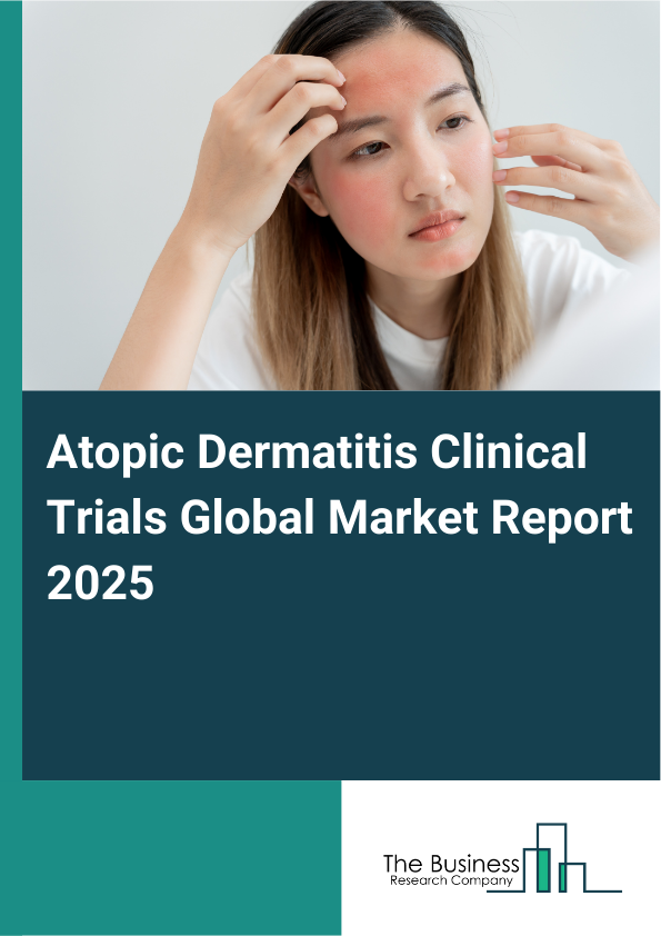 Global Atopic Dermatitis Clinical Trials Market Report 2025