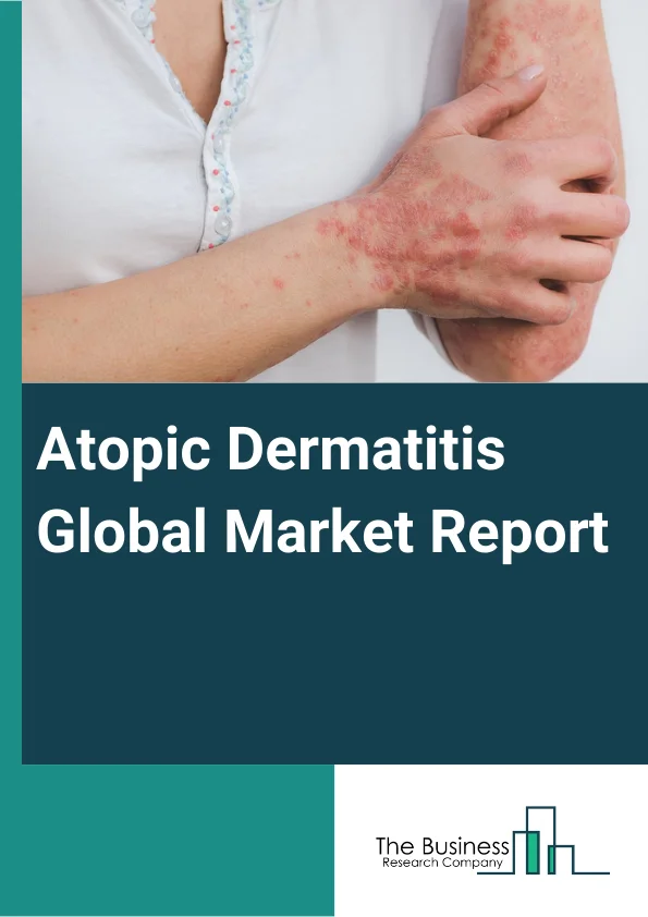 Atopic Dermatitis Global Market Report 2023 – By Drug Class (Corticosteroids, Emollients or Moisturizers, IL-4 and PDE4 Inhibitors, Calcineurin Inhibitors, Antibiotics, Other Drug Classes), By Mode of Administration (Topical, Injectable, Oral), By Distribution Channel (Hospital Pharmacies, Retail Pharmacies, Online Pharmacies) – Market Size, Trends, And Global Forecast 2023-2032