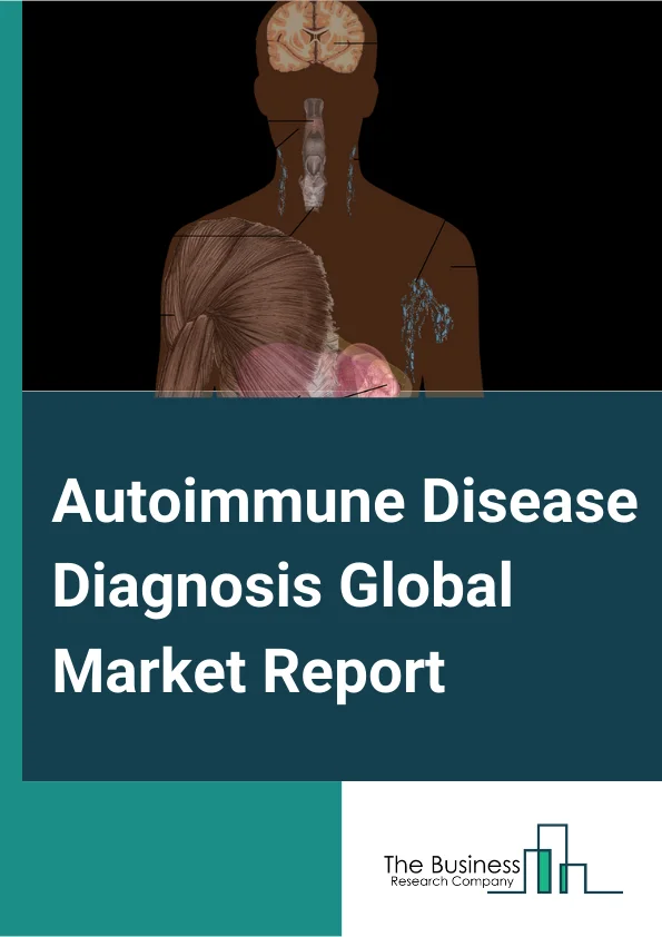 Autoimmune Disease Diagnosis Global Market Report 2024 – By Product (Consumables And Assay Kits, Instruments), By End User (Clinical Laboratories, Hospitals, Others), By Test Type (Routine Laboratory Tests, Autoantibodies Tests, Immunologic Tests, Other Tests) – Market Size, Trends, And Global Forecast 2024-2033