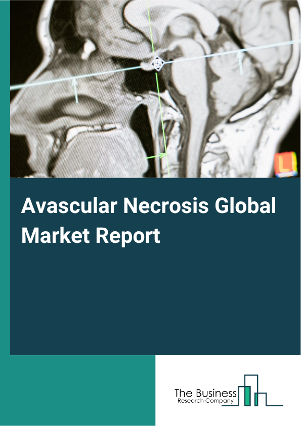 Global Avascular Necrosis Market Report 2025