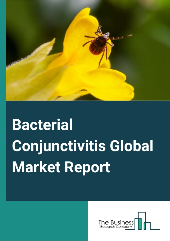 Bacterial Conjunctivitis Global Market Report 2025 – By Types (Hyperacute Bacterial Conjunctivitis, Acute Bacterial Conjunctivitis, Chronic Bacterial Conjunctivitis), By Drug Class (Antibiotics, Fluoroquinolones, Aminoglycosides, Macrolides, Antihistamines, Corticosteroids, Other Drug Classes), By Route of Administration (Oral, Topical, Other Routes Of Administrations), By Distribution Channel (Hospital Pharmacy, Retail Pharmacy, Online Pharmacy, Other Distribution Channels) – Market Size, Trends, And Global Forecast 2025-2034