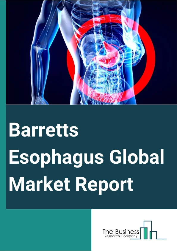 Barrett's Esophagus Global Market Report 2024 – By Type (No Dysplasia, Low-Grade Dysplasia, High Grade Dysplasia, Other Types), By Treatment (Medication, Endoscopic Therapy, Surgery, Other Treatments), By Route Of Administration (Oral, Parenteral, Rectal, Other Routes Of Administration), By Distribution Channel (Hospital Pharmacy, Retail Pharmacy, Online Pharmacy, Other Distribution Channels) – Market Size, Trends, And Global Forecast 2024-2033