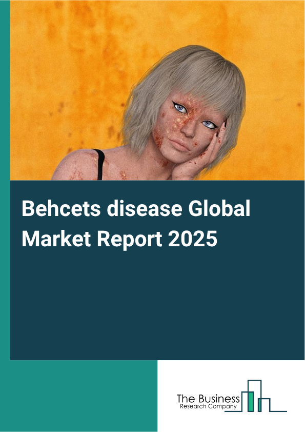Global Behcets disease Market Report 2025