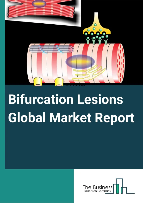 Bifurcation Lesions Market Report 2023 