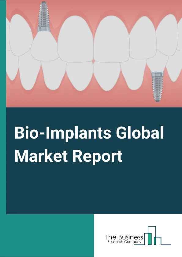 Bio-Implants Market Report 2023 