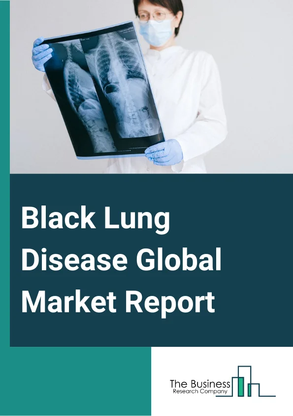Black Lung Disease Global Market Report 2024 