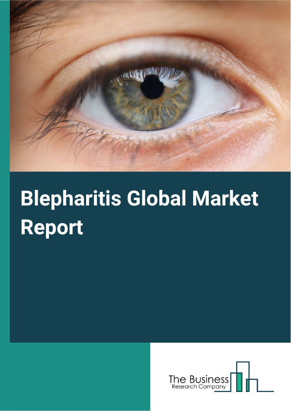 Global Blepharitis Market Report 2025 