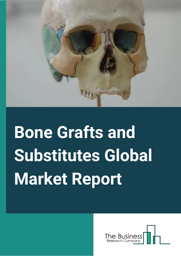 Bone Grafts and Substitutes Global Market Report 2025 – By Material (Allograft, Synthetic, Xenograft), By Application (Spinal Fusion, Trauma, Craniomaxillofacial, Joint Reconstruction, Dental Bone Grafting, Other Applications), By End User (Hospitals and Clinics, Surgical Centers, Other End-Users) – Market Size, Trends, And Global Forecast 2025-2034