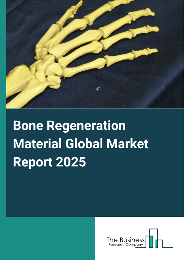 Global Bone Regeneration Material Market Report 2025