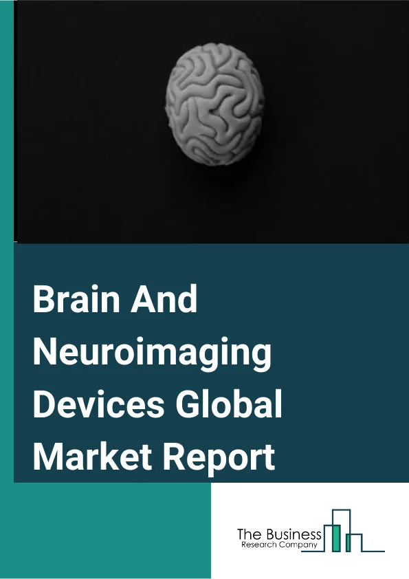 Brain And Neuroimaging Devices Global Market Report 2023 – By Imaging Type (Functional Magnetic Resonance Imaging (fMRI), Computed Tomography (CT), Positron Emission Tomography (PET), Electroencephalography (EEG), Magneto Encephalography (MEG), Other Imaging Types), By End-user (Hospitals, Diagnostic Centres, Ambulatory Surgical Centres), By Application (Parkinson’s Disease, Traumatic Brain Injury, Epilepsy, Dementia, Sleep Disorders, Other Applications) – Market Size, Trends, And Global Forecast 2023-2032