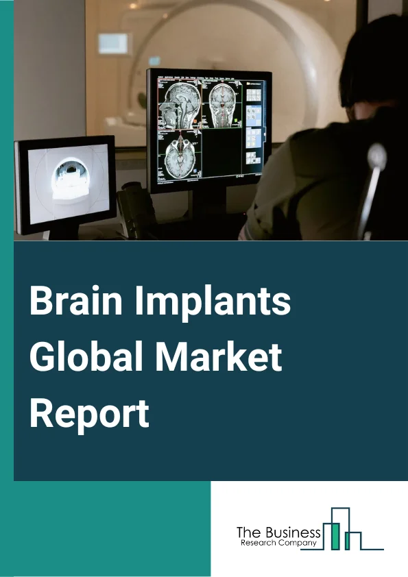 Brain Implants