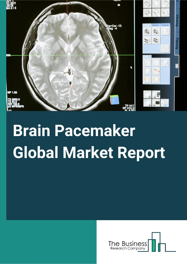 Global Brain Pacemaker Market Report 2025