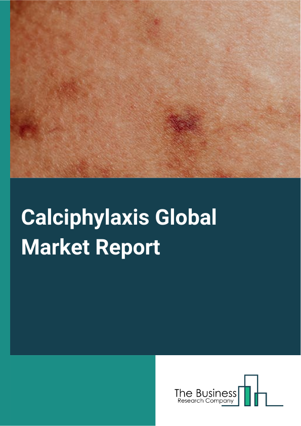 Global Calciphylaxis Market Report 2025