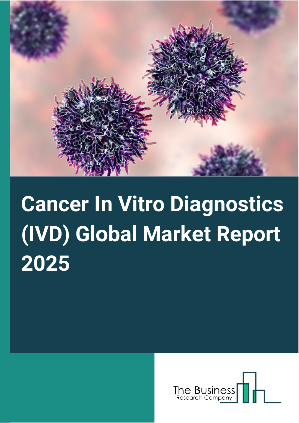 Global Cancer In Vitro Diagnostics (IVD) Market Report 2025