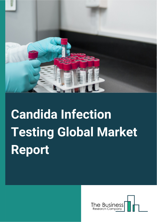 Candida Infection Testing Global Market Report 2025 – By Type (Invasive Candidiasis, Candidemia), By Test Type (Vaginal pH Test, Nucleic Acid Amplification Testing (NAAT), Microbiome Test), By Application (Hospital, Laboratory) – Market Size, Trends, And Global Forecast 2025-2034