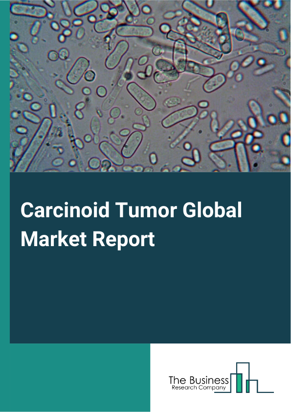 Global Carcinoid Tumor Market Report 2025