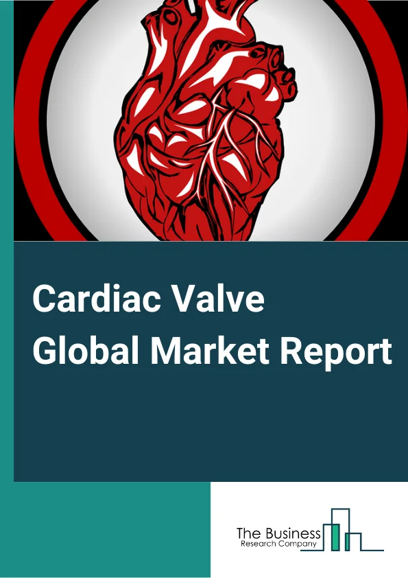 Cardiac Valve Global Market Report 2024 – By Type (Tissue Heart Valves, Transcatheter Heart Valves, Mechanical Heart Valves, Other Types), By Position (Aortic Valve, Mitral Valve, Other Positions), By Treatment (Cardiac Valve Repair, Cardiac Valve Replacement), By End-Users (Hospital And Clinics, Specialty Centers, Cardiac Research Institute, Other End Users) – Market Size, Trends, And Global Forecast 2024-2033