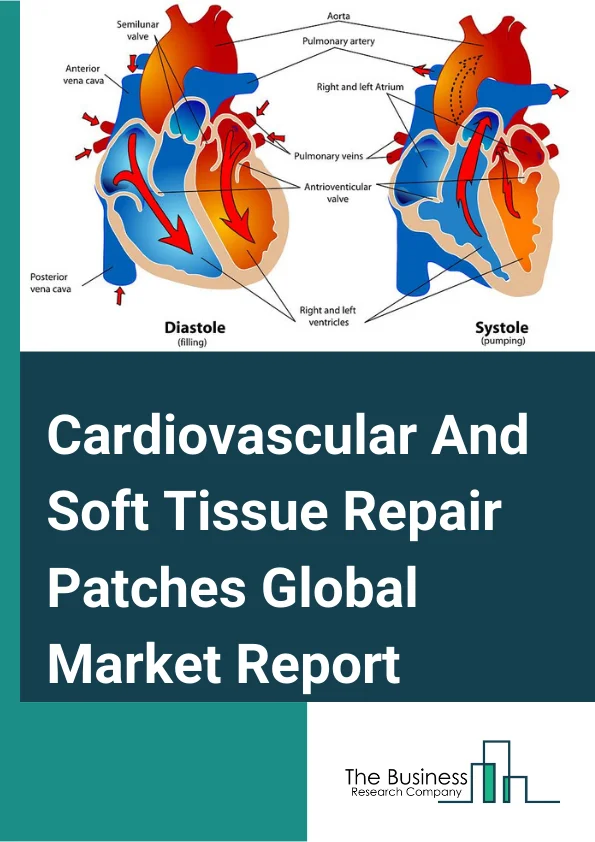 Cardiovascular And Soft Tissue Repair Patches Global Market Report 2024 – By Raw Materials (ePTFE, Biomaterial And Tissue-Engineered Material, Other Raw Materials ), By Product (Synthetic Patch, Biologic Patch), By Application (Cardiac Repair, Atrial Septal Defect, Common Atrium, Defects Of The Endocardial Cushion, Ventricular Septal Defect, Tetralogy Of Fallot, Right Ventricular Outflow Tract Reconstruction, Suture Bleeding, Vascular Repair And Reconstruction, Transposition Of The Great Vessels ), By End User (Hospitals, Ambulatory Surgical Centers, Specialty Clinics) – Market Size, Trends, And Global Forecast 2024-2033