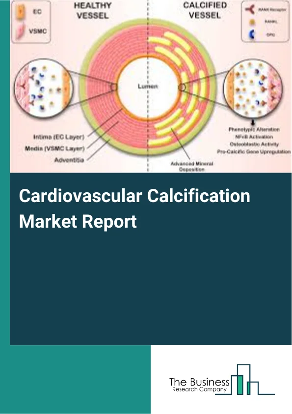 Cardiovascular Calcification Market Report Infographic Image
