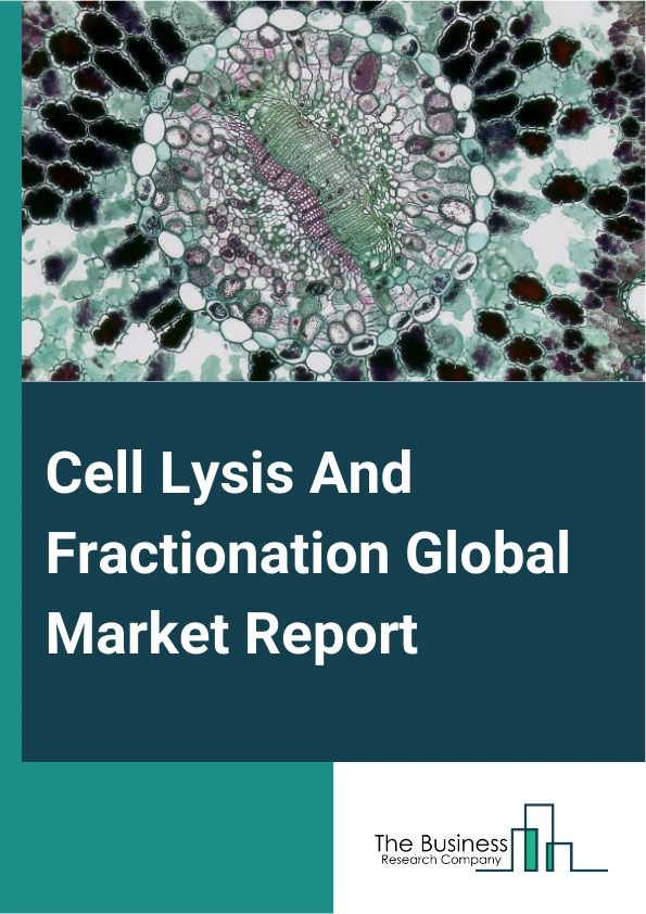 Cell Lysis And Fractionation Global Market Report 2025 – By Type (Mammalian Cells, Microbial Cells), By Application (Nucleic Acid Purification And Isolation, Protein Purification And Isolation), By End-User (Research Laboratories And Institutes, Biopharmaceutical, Biotechnology Companies) – Market Size, Trends, And Global Forecast 2025-2034