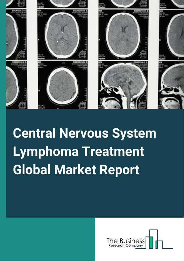 Global Central Nervous System Lymphoma Treatment Market Report 2025