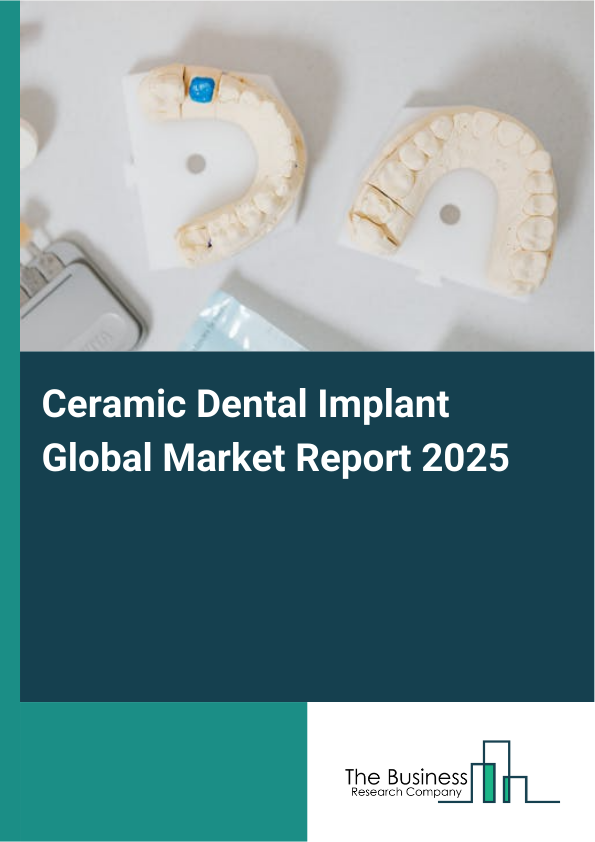 Global Ceramic Dental Implant Market Report 2025