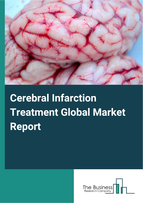 Global Cerebral Infarction Treatment Market Report 2025
