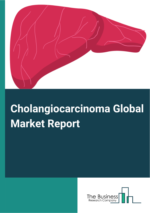 Global Cholangiocarcinoma Market Report 2025