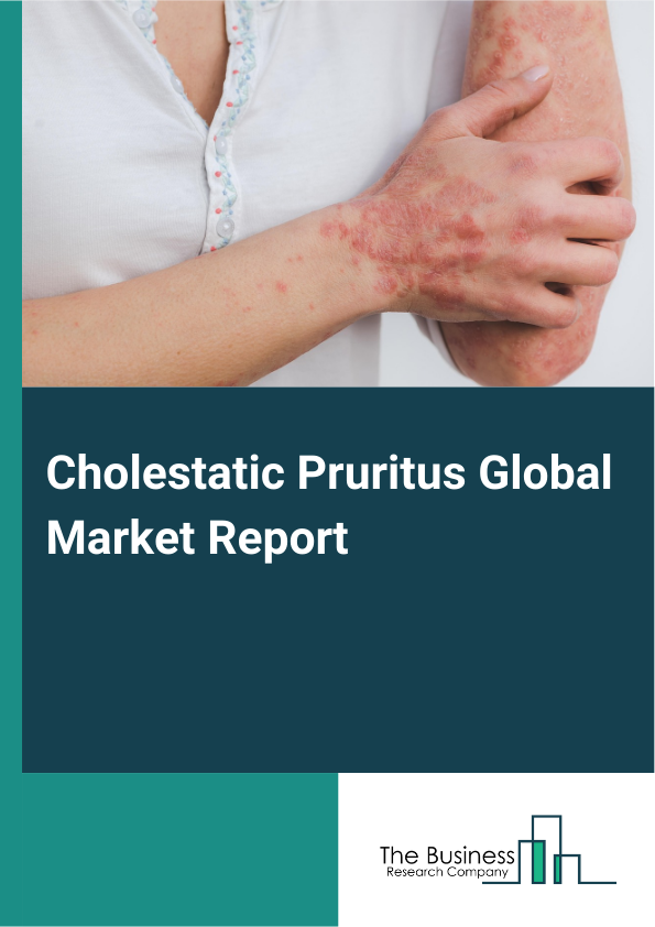 Global Cholestatic Pruritus Market Report 2025