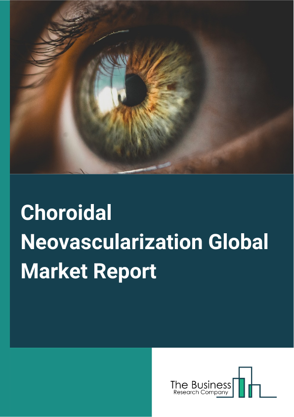 Global Choroidal Neovascularization Market Report 2025