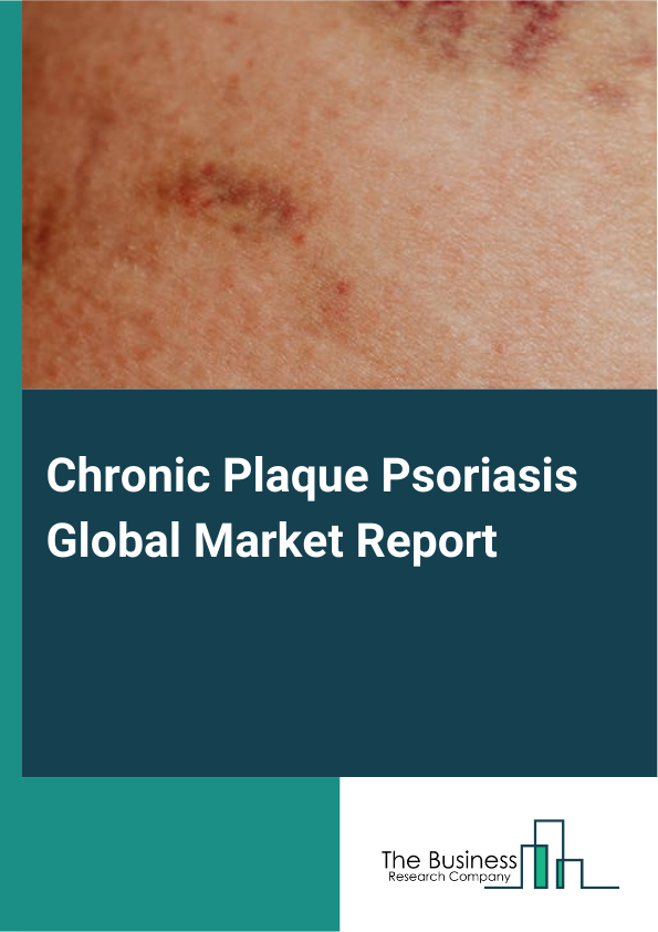 Global Chronic Plaque Psoriasis Market Report 2025