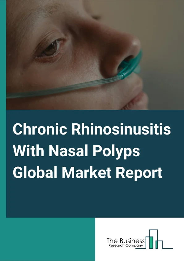 Chronic Rhinosinusitis With Nasal Polyps Global Market Report 2025 – By Treatment (Medications, Surgical Methods), By Route Of Administration (Nasal, Oral, Other Routes Of Administration), By Distribution Channel (Hospital Pharmacies, Retail Pharmacies, Online Pharmacies) – Market Size, Trends, And Global Forecast 2025-2034