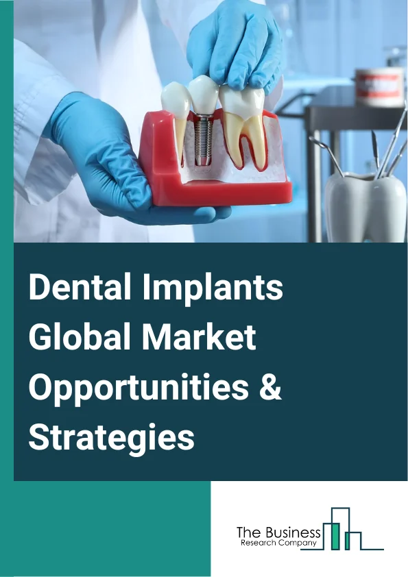 Dental Implants Market 2023 – By Product (Tapered Implants, Parallel Walled Implants), By Material (Titanium, Zirconium, Other Materials), By End-Use (Hospitals, Dental Clinics, Other End Uses), And By Region, Opportunities And Strategies – Global Forecast To 2032