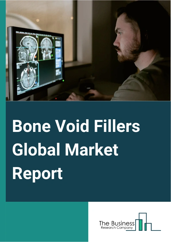 Bone Void Fillers Global Market Report 2024 – By Type (Demineralized Bone Matrix, Calcium phosphate Bone Graft Substitute, Collagen Matrix, Other Types), By Form (Gel And Putty, Granules, Other Forms), By Application (Bone Fracture, Spine Fusion, Other Applications), By End-User (Hospital, Specialty Clinics) – Market Size, Trends, And Global Forecast 2024-2033