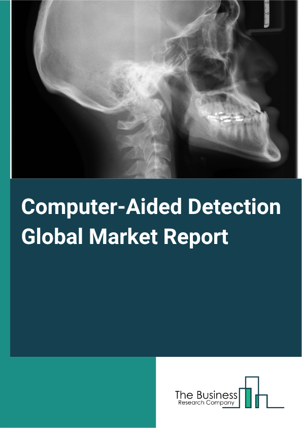 Global Computer-Aided Detection Market Report 2025 