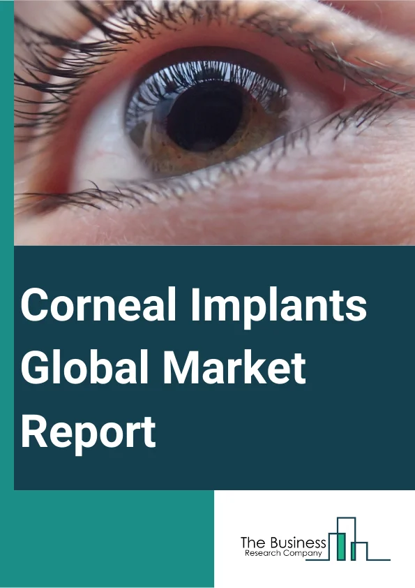 Corneal Implants Global Market Report 2025 – By Implant Type (Artificial Corneal Implant, Human Corneal Implant), By Procedure Type (Endothelial Keratoplasty, Penetrating Keratoplasty, Other Procedure Types), By Application (Keratoconus, Fuchs Dystrophy, Infectious Keratitis, Corneal Ulcers, Other Applications), By End-User (Hospitals, Ophthalmic Center, Other End-Users) – Market Size, Trends, And Global Forecast 2025-2034