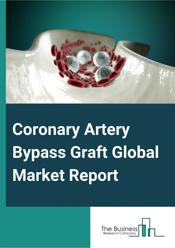 Coronary Artery Bypass Graft Global Market Report 2025 – By Procedure (Single Coronary Artery Bypass Graft (CABG) Surgery, Double Coronary Artery Bypass Graft (CABG) Surgery, Triple Coronary Artery Bypass Graft (CABG) Surgery, Quadruple Coronary Artery Bypass Graft (CABG) Surgery, Other Procedures), By Method (Off-pump, On-pump), By End-Use (Hospitals, Cardiology Clinics, Research Institutes, Other End-Users) – Market Size, Trends, And Global Forecast 2025-2034