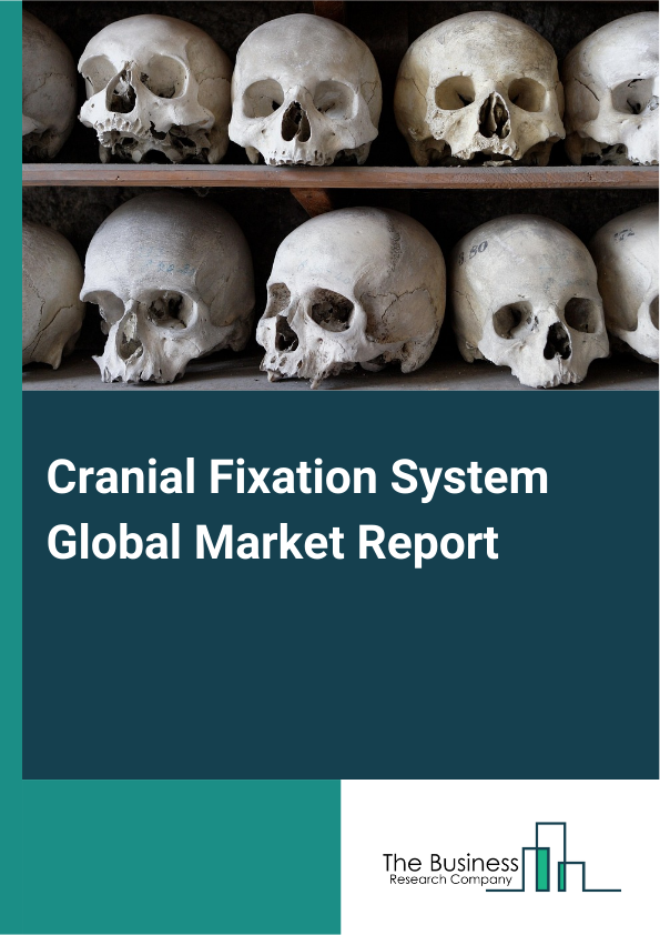 Global Cranial Fixation System Market Report 2025