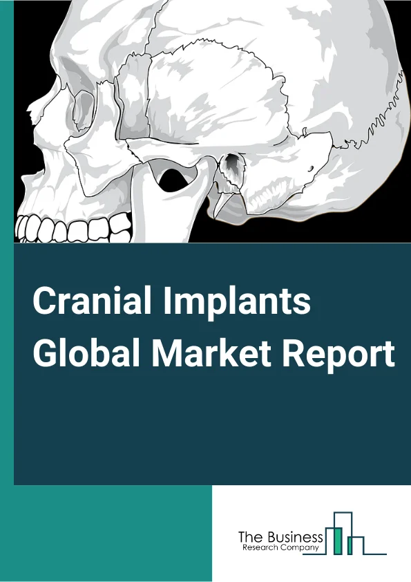 Cranial Implants Global Market Report 2025 – By Type (Customized Cranial Implants, Non-customized Cranial Implants), By Material (Polymer, Ceramic, Metal), By End User (Hospital and Trauma Centers, Ambulatory Surgical Centers, Specialty Clinics, Other End-Users ) – Market Size, Trends, And Global Forecast 2025-2034