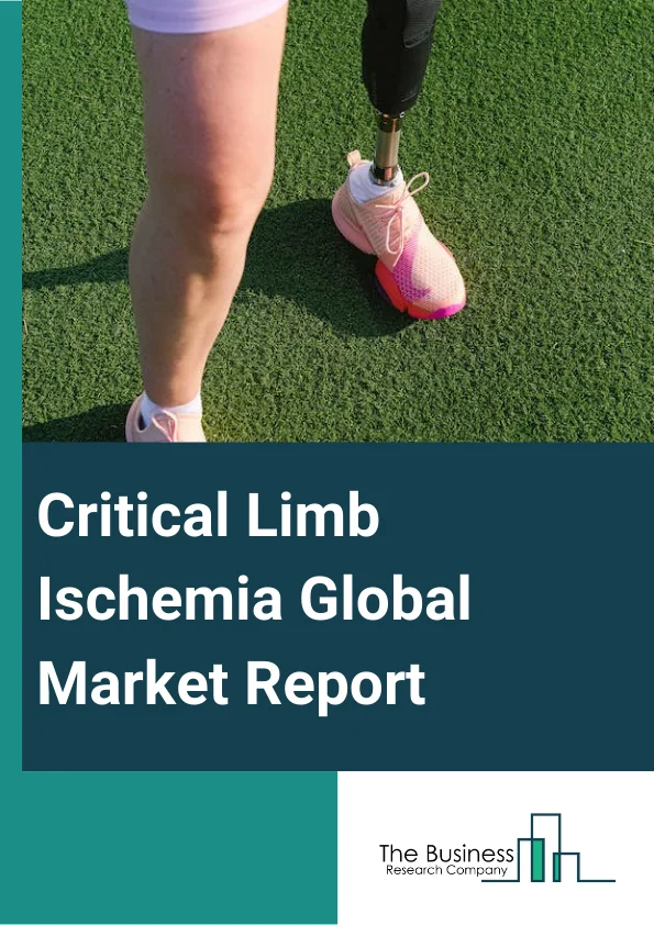Critical Limb Ischemia Global Market Report 2023